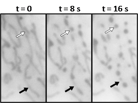 Mitochondrial fission